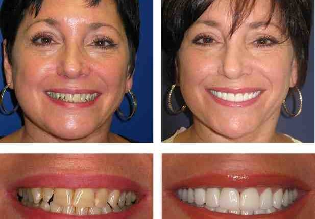 Rock cosmetic dentistry nyc