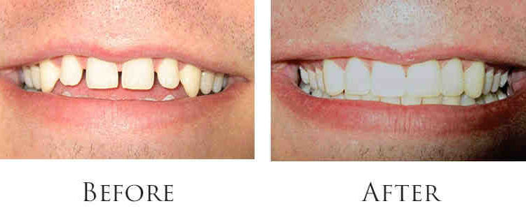 Santa barbara cosmetic dentistry
