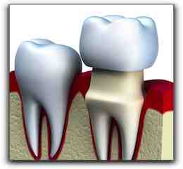 What are fake tooth called?