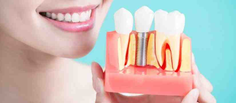 What disqualifies you from getting dental implants?