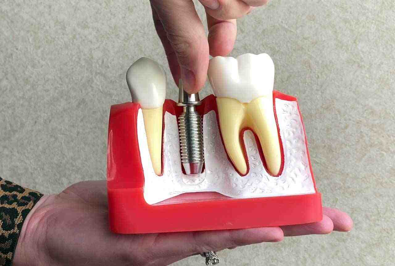 What does it mean if tooth implant is loose?