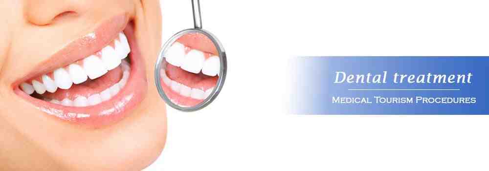 What is a British smile?