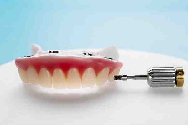 What is the downside of dental implants?