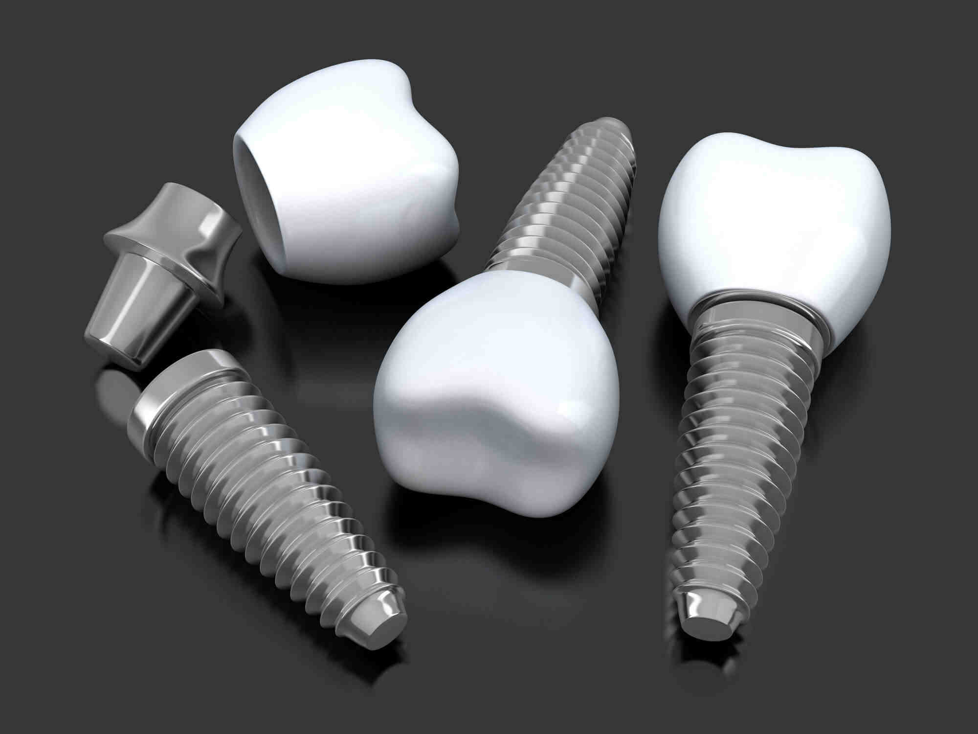 What should you not drink after dental implants?