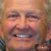 What's the fake teeth called?