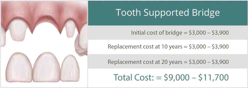 Who Cannot have dental implants?