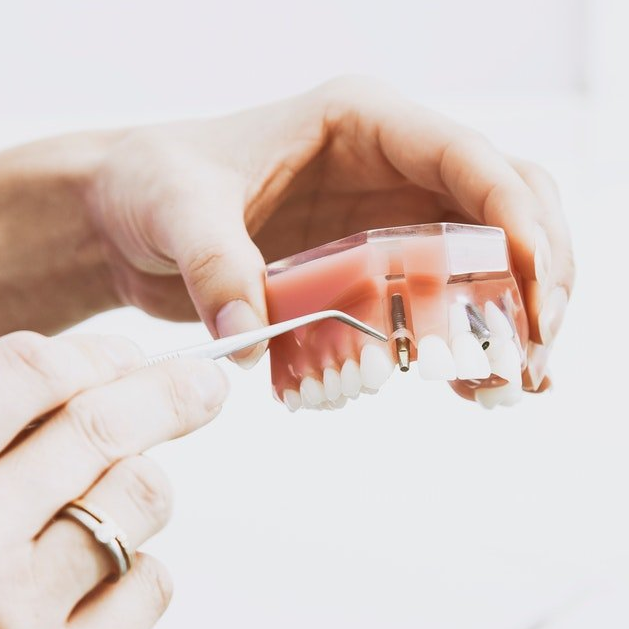 Are dental implants hard to maintain?