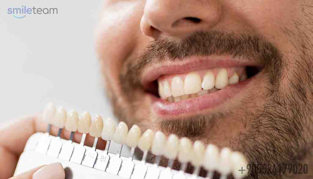 How much is a full set of veneers? Dental News Network