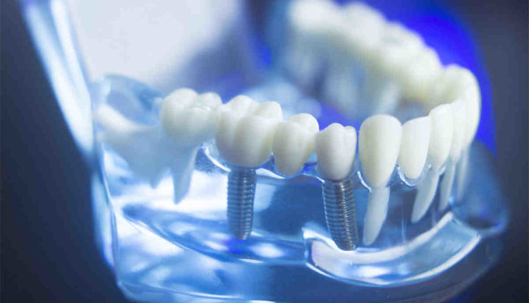 Are water piks damaging to dental implants