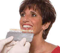 Can I brush after veneers?