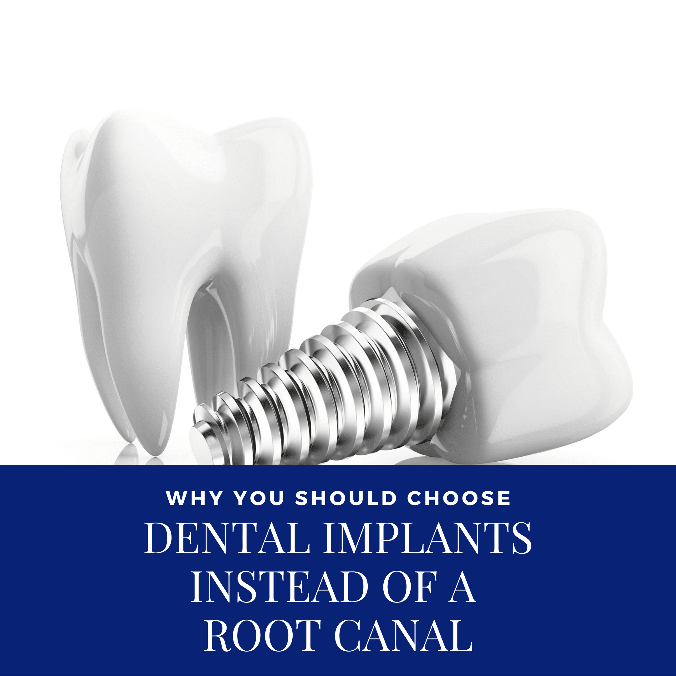 Can a dental implant replace a root canal?
