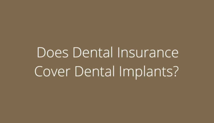 Can dental implant be covered under dental insurance