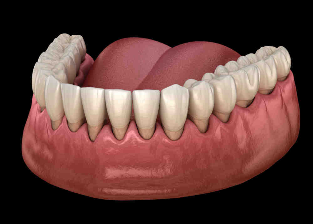 Can dental implants last 50 years?