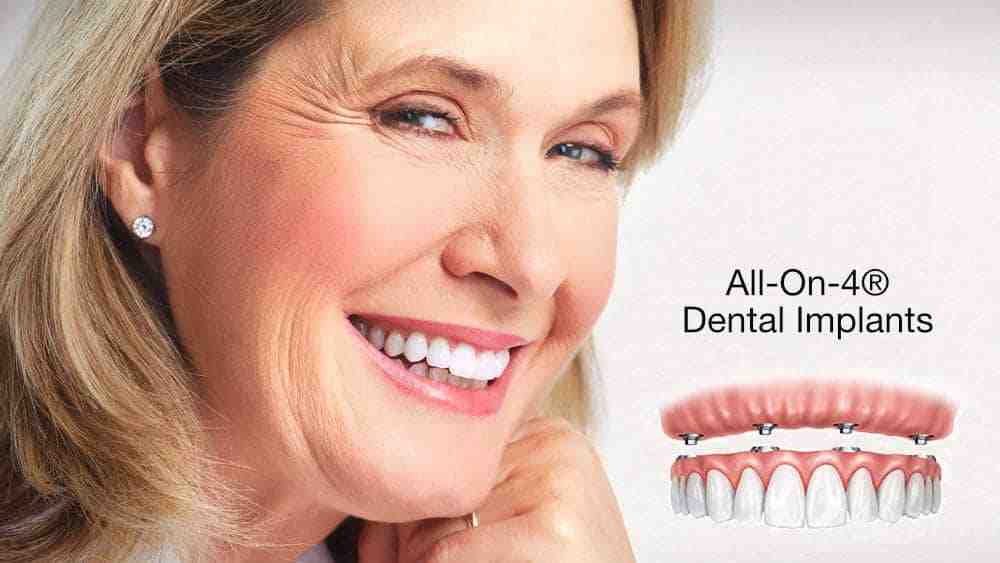 Can dentures be permanently glued in?