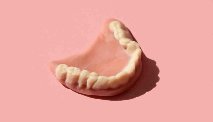 Can dentures be permanently glued in?