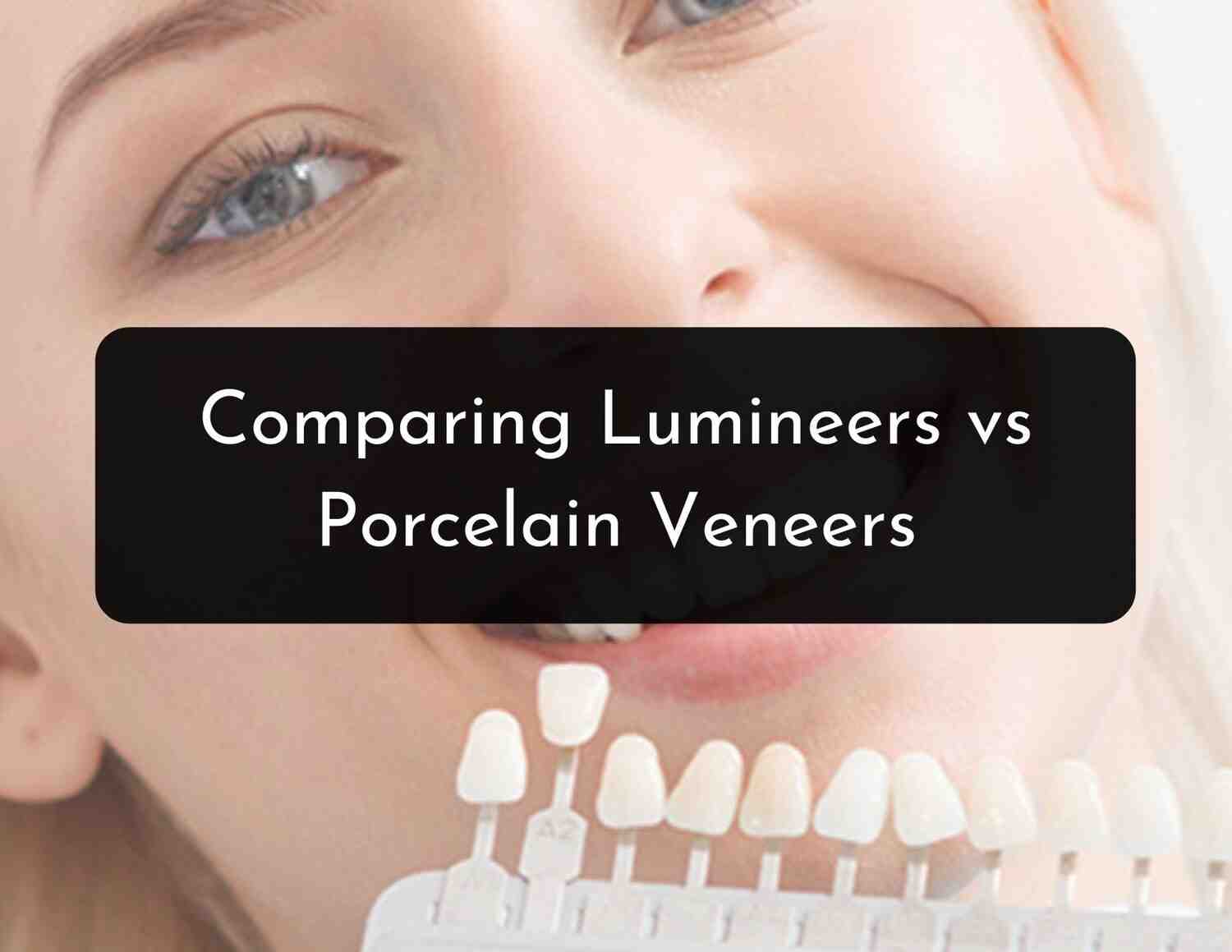 Which is better Lumineers or veneers? Dental News Network