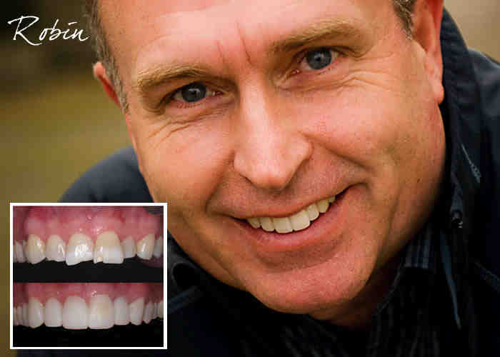 Can stem cells be used to grow new teeth?