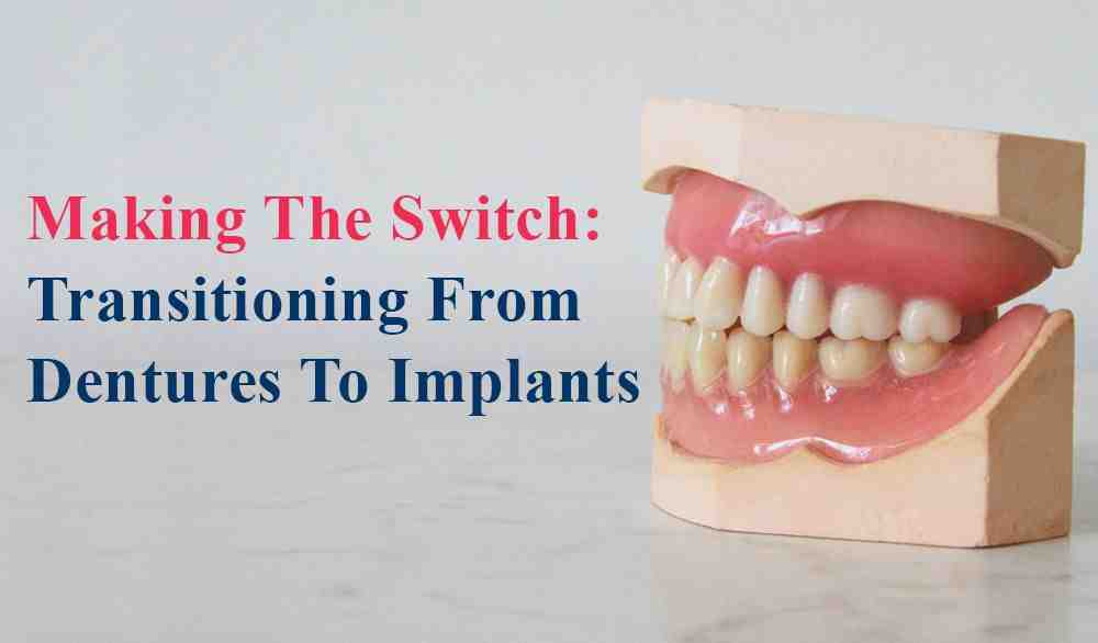 Can you get dental implants after dentures Dental News Network