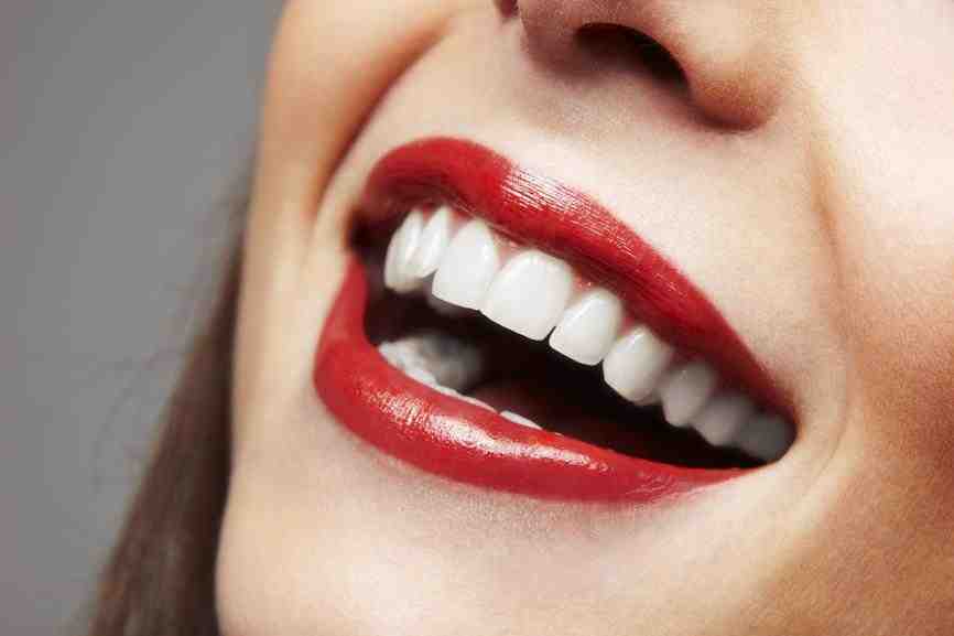 Can you just do 4 veneers?