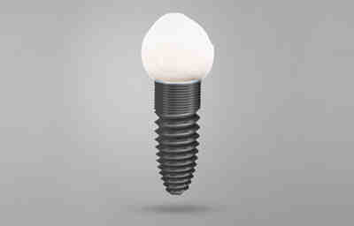 Can you use mouthwash with dental implants?