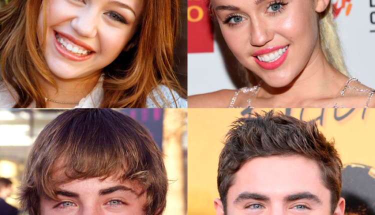 Do all celebrities have veneers?