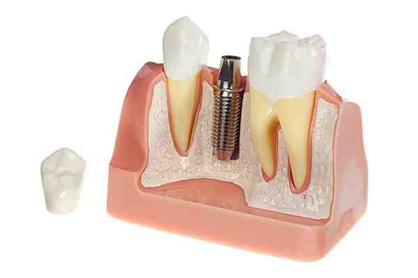 Do dental products need FDA approval?