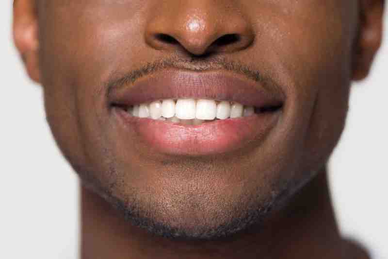 Do veneers last a lifetime? Dental News Network