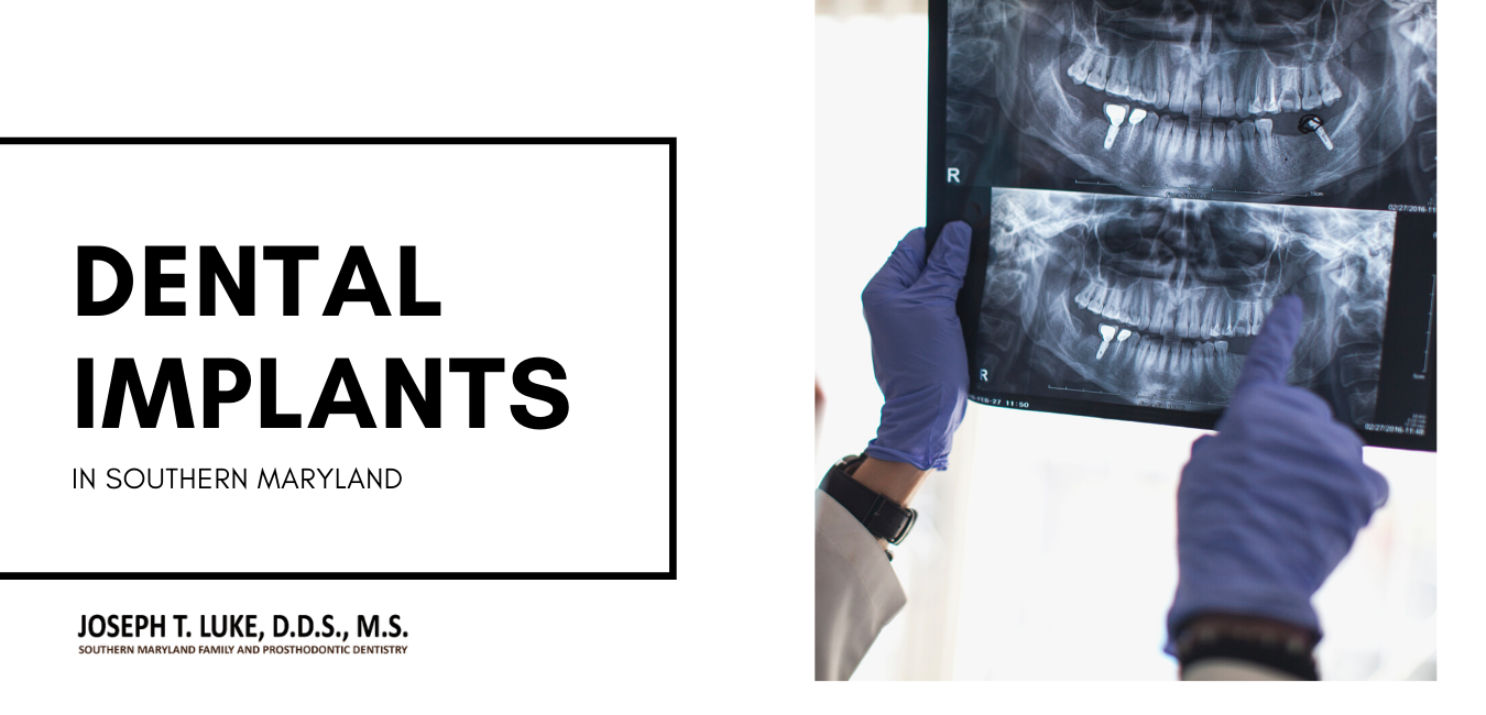 Do you have stitches after dental implant?