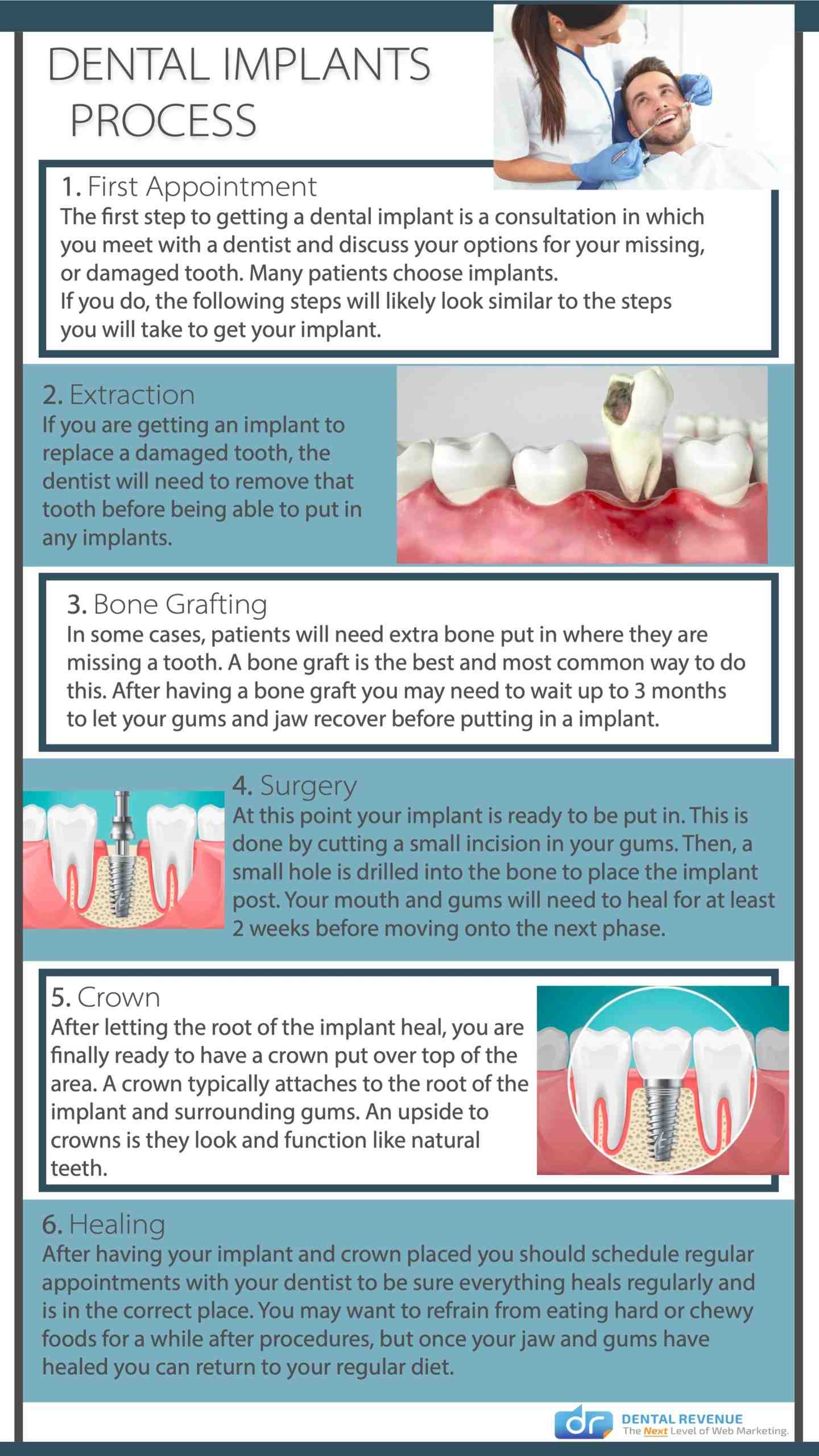 Do you have to go without teeth while getting implants?