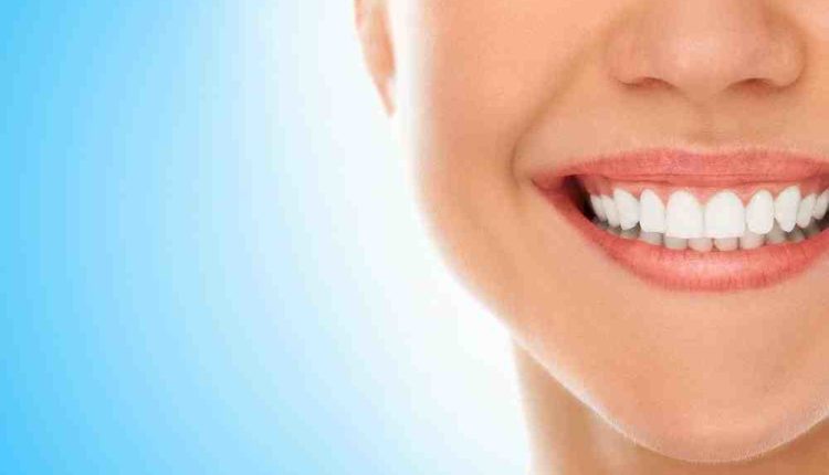 Do you need straight teeth before veneers?