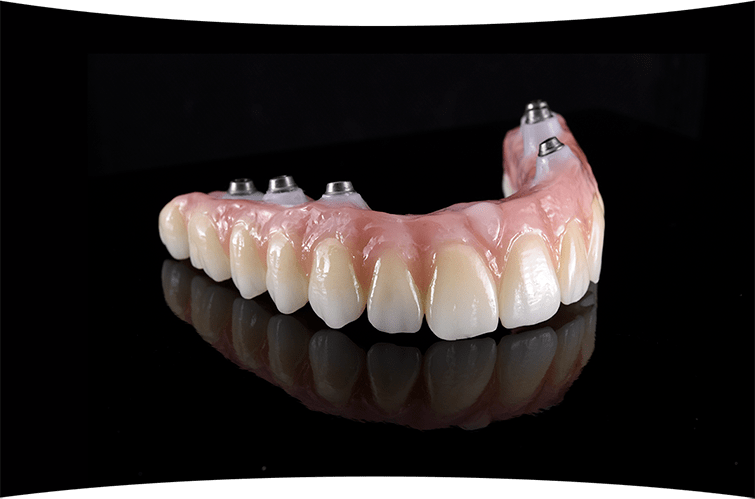 How do I keep my dental implants clean and hygienic?