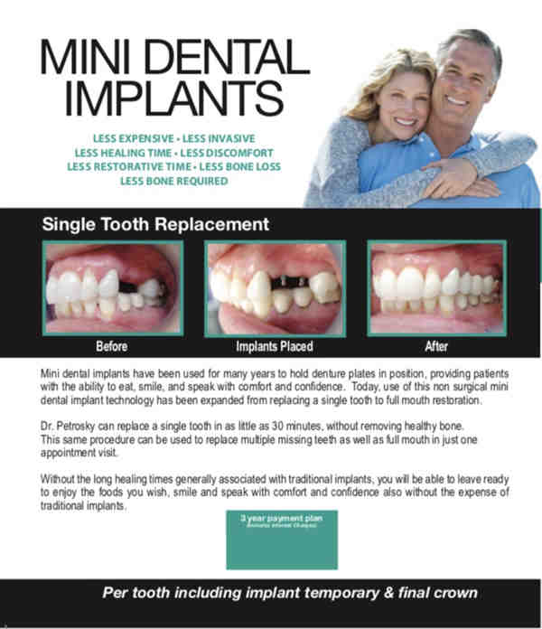 How much of the upper palate can be removed with mini dental implants