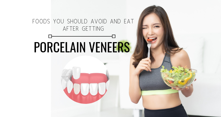 How long after veneers can I eat?