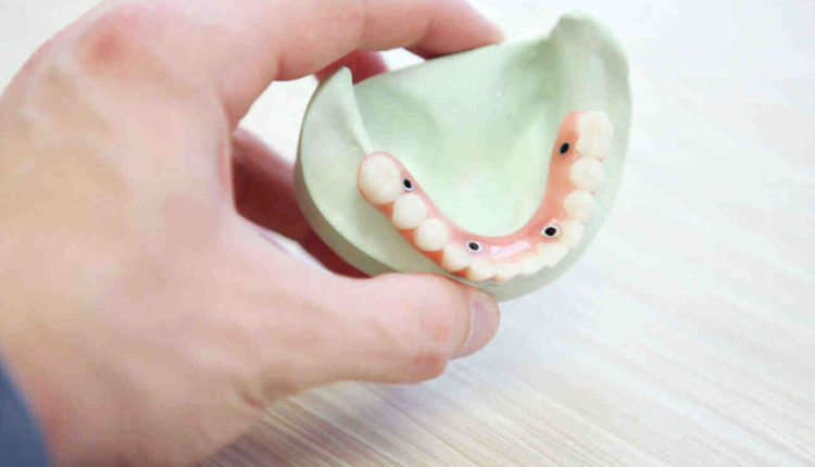 How long do you have to wait to get dentures after teeth are pulled?