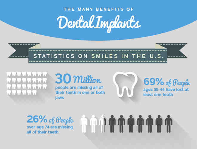 How long does a dental implant last?