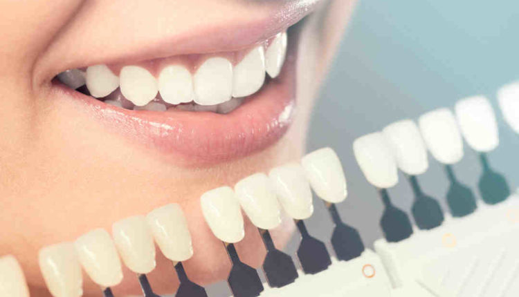 How long does porcelain teeth last?