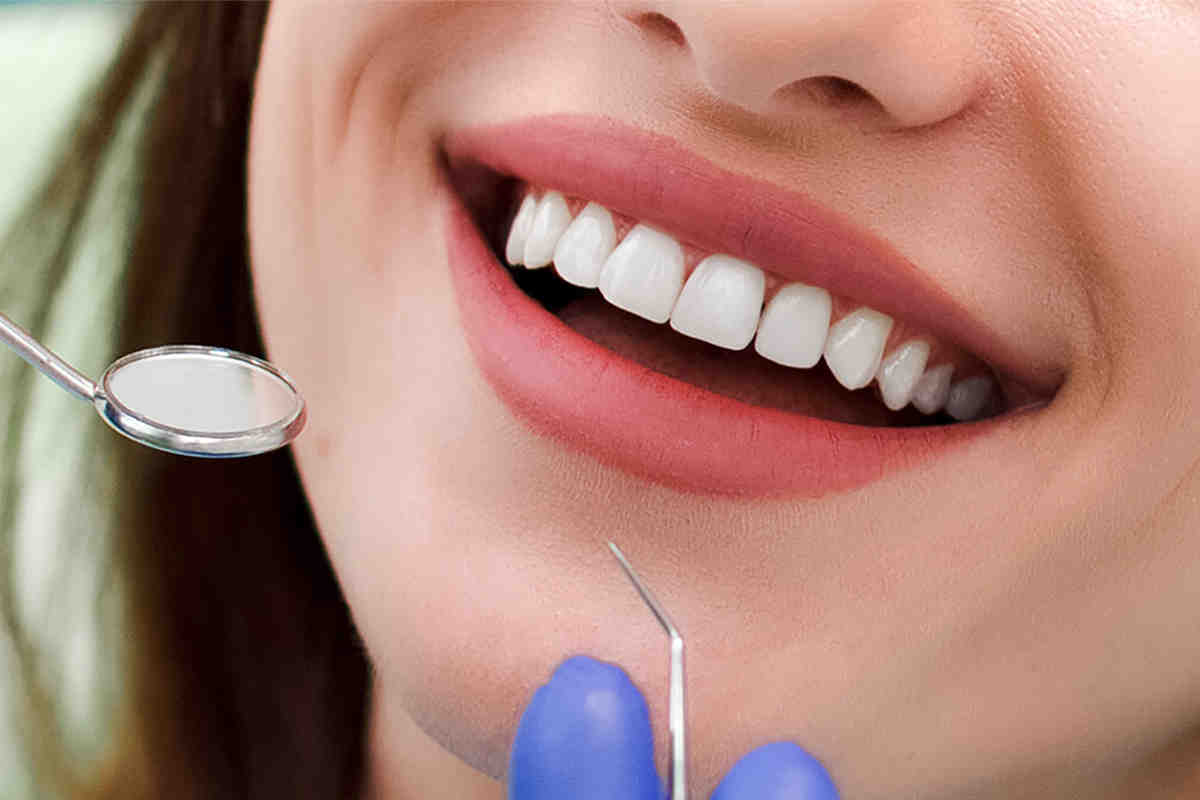 How many teeth should show when you smile?