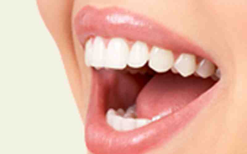 How much do all on 4 dental implants cost UK?