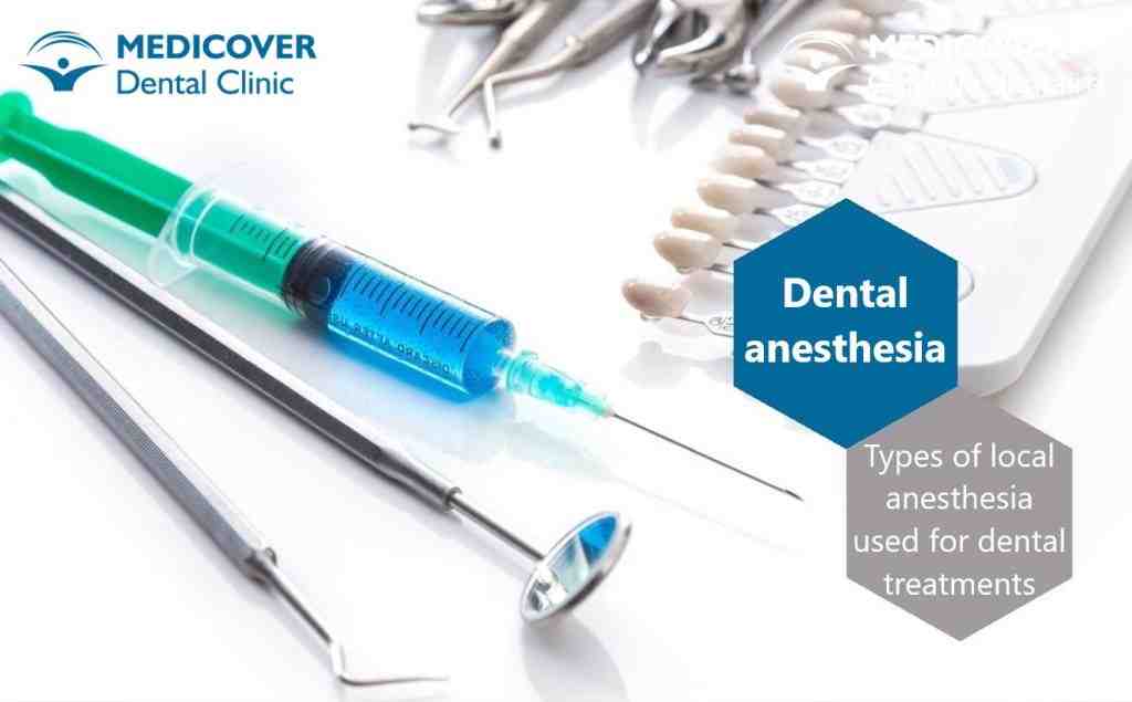 How much do dental implants cost?