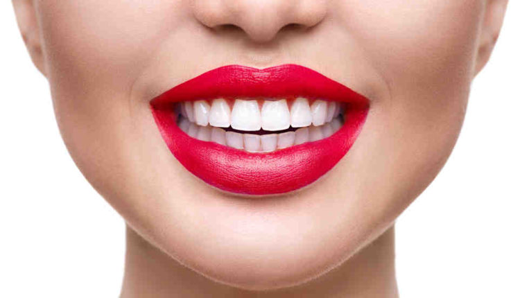 How much do veneers cost in San Diego?