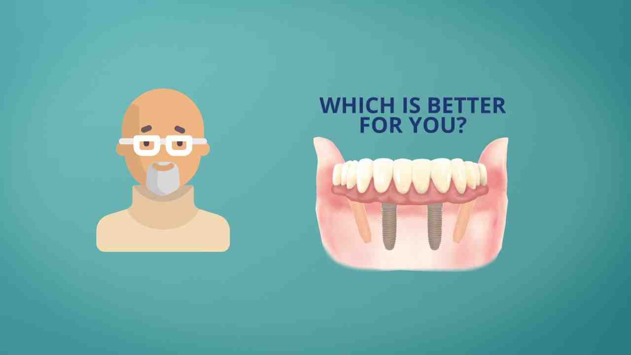 How much does it cost to remove an implant?