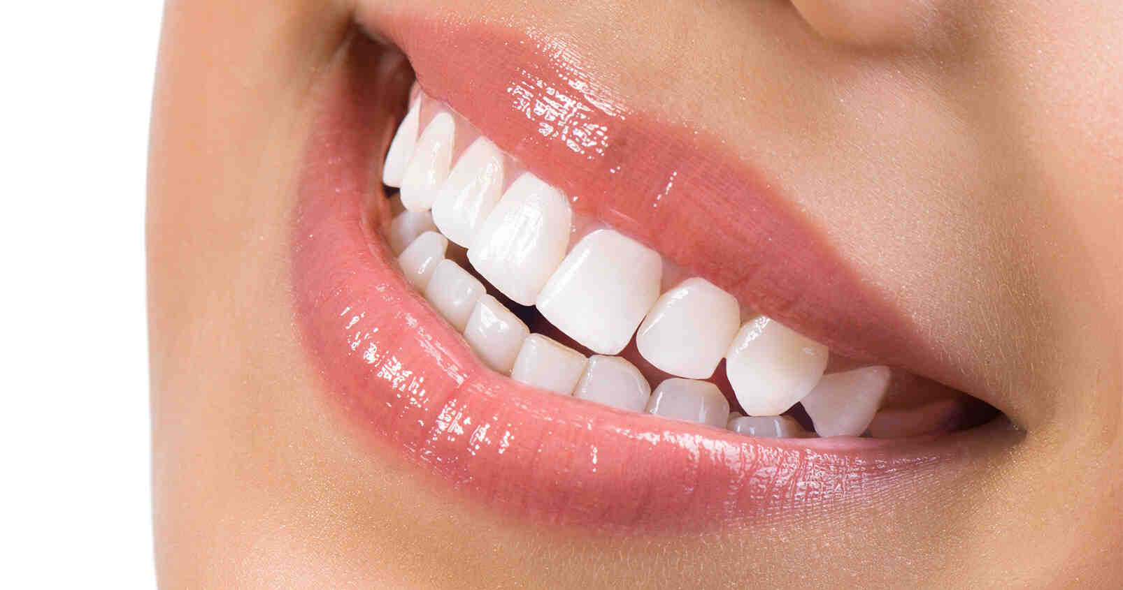 How much does it cost to replace smile?
