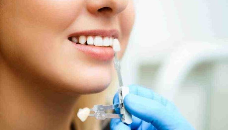 How to et insurance t covr dental implants