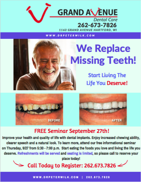 Is Hollywood smile same as veneers?