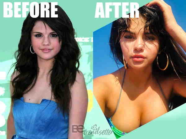 Is Selena Gomez still friends with her kidney donor?