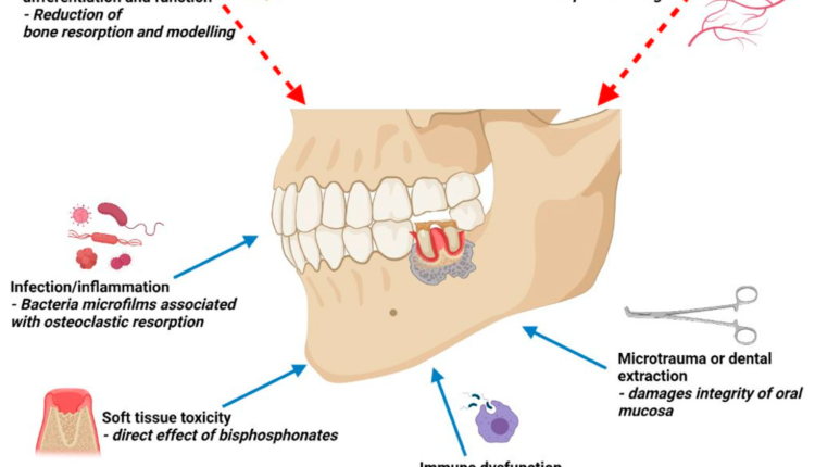 Is jeromy mao accepting volunteers for stem cell dental implants