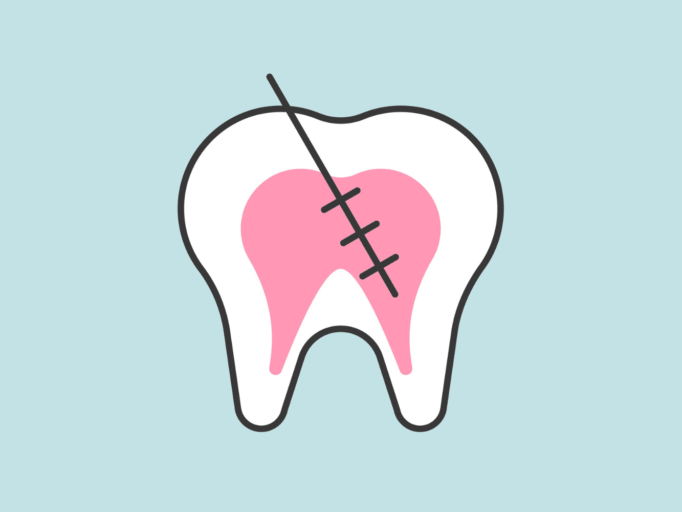 Is re RCT painful?