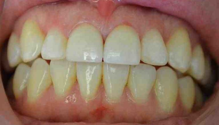 Seattle cosmetic dentistry reviews
