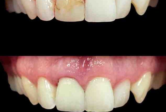 Shere dds cosmetic dentistry