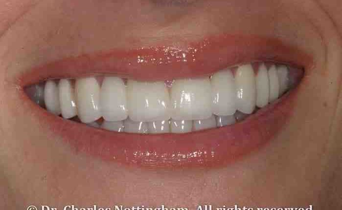 Smile south florida cosmetic dentistry